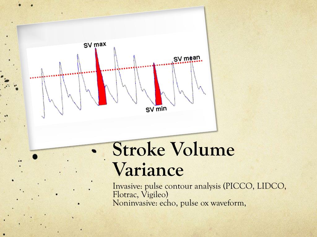 PPT Fluid Responsiveness PowerPoint Presentation, free download ID