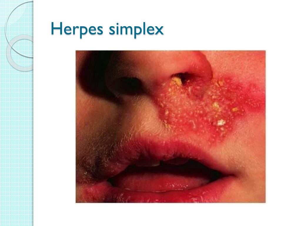 PPT INTEGUMENTARY Nursing care PowerPoint Presentation, free download