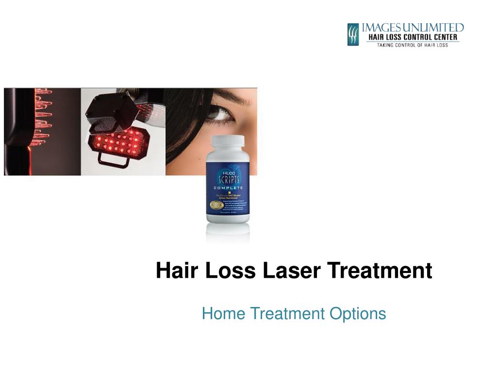 PPT Hair Loss Laser Treatment Home Treatment Options PowerPoint