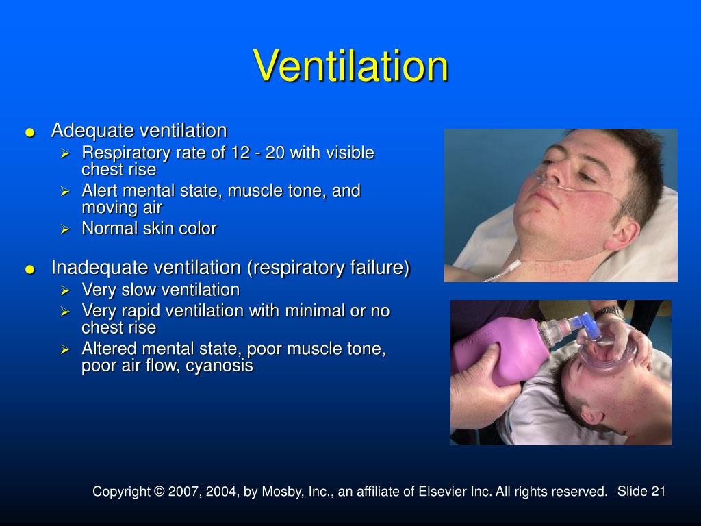 PPT Airway PowerPoint Presentation, free download ID2411098