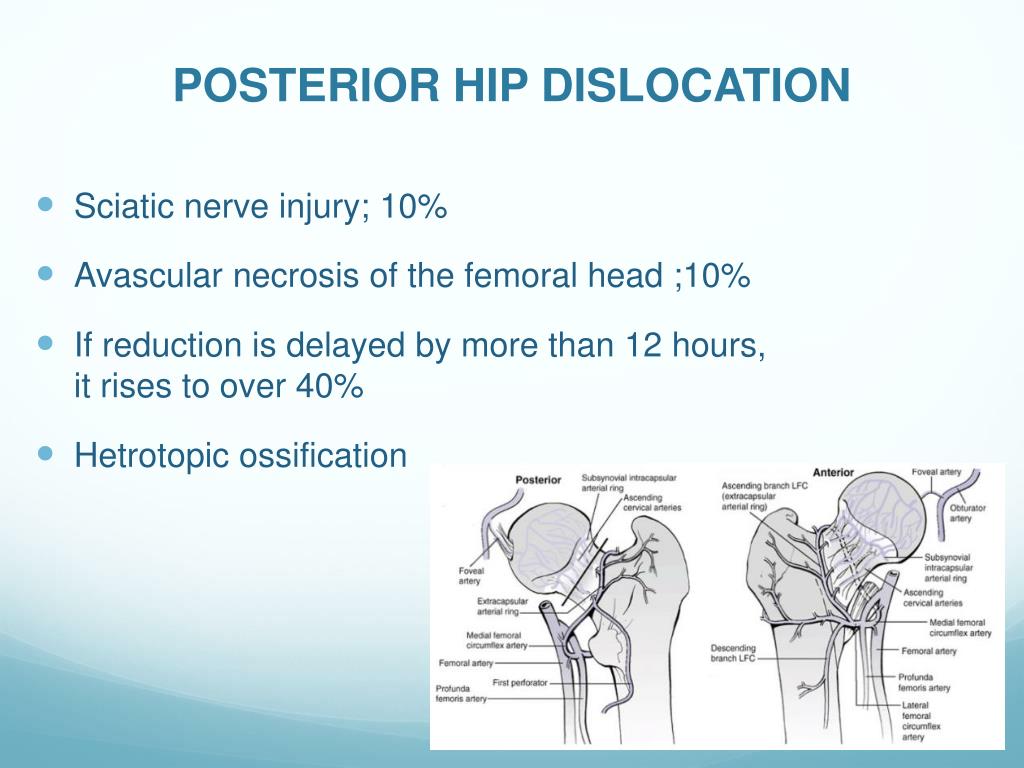 PPT Acute Joint Dislocation PowerPoint Presentation, free download