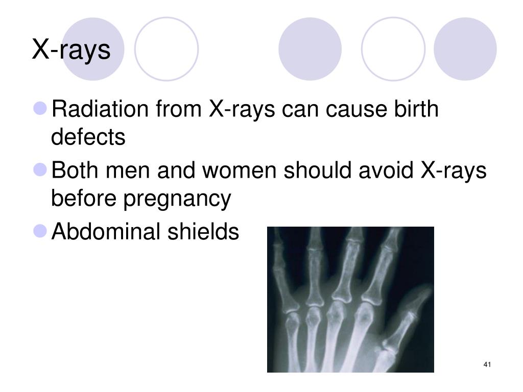 PPT Pregnancy and Childbirth PowerPoint Presentation, free download