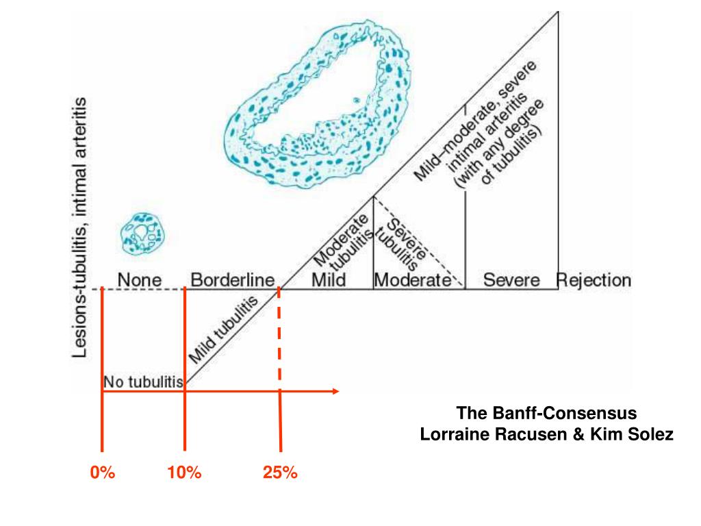 PPT Significance of the total i score PowerPoint Presentation, free