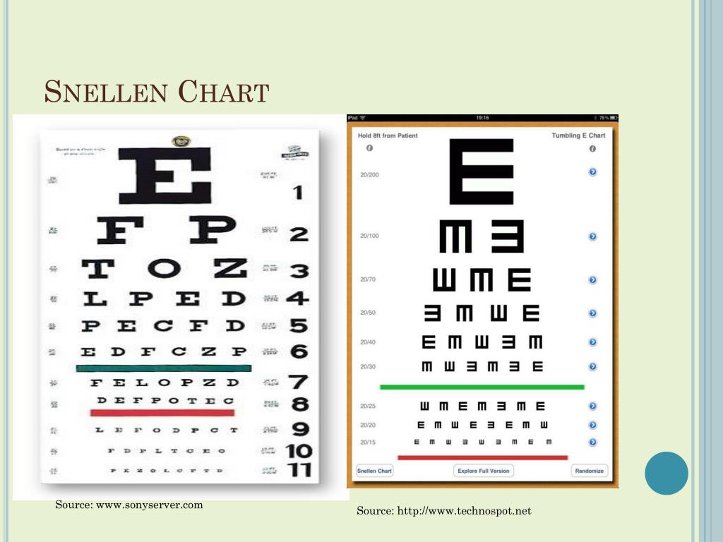 PPT Visual Impairment PowerPoint Presentation, free download ID2459901
