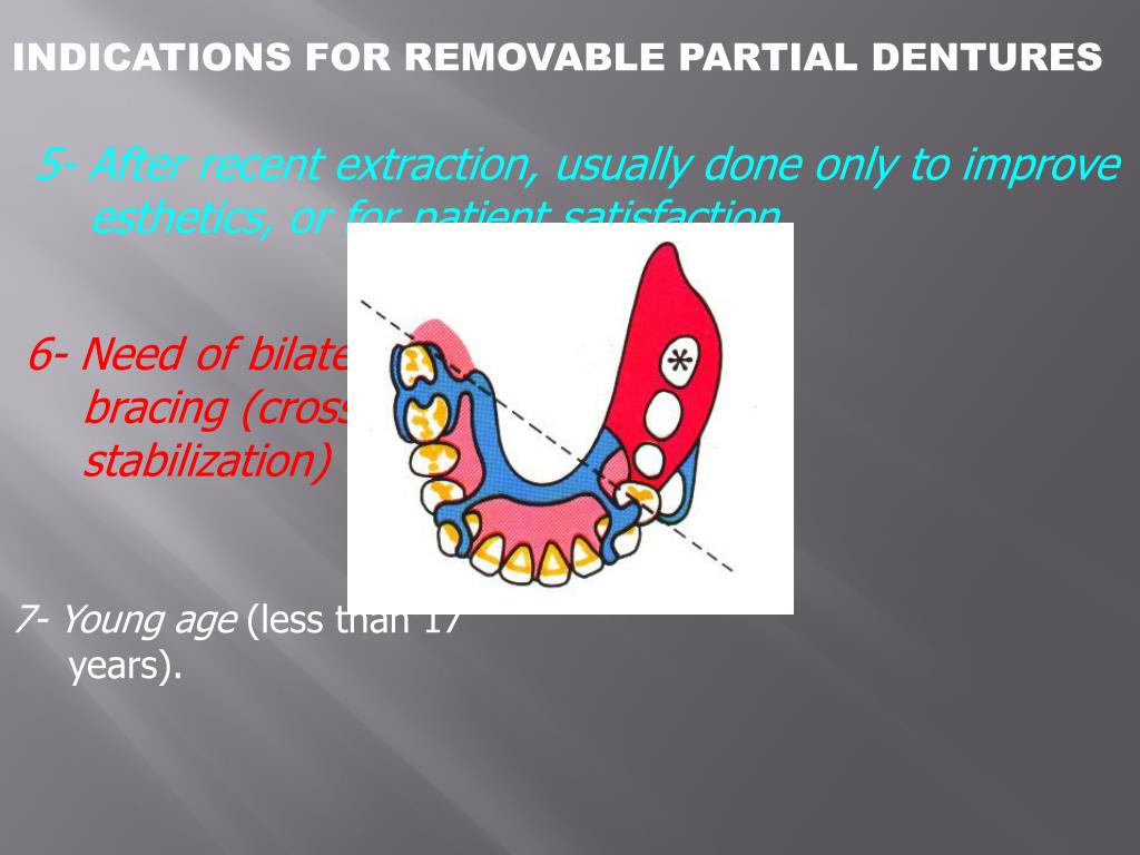 PPT REMOVABLE PARTIAL DENTURES PowerPoint Presentation, free download ID2484276