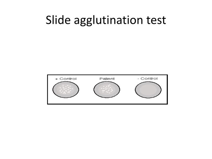 PPT Antigen antibody reactions PowerPoint Presentation ID2494521
