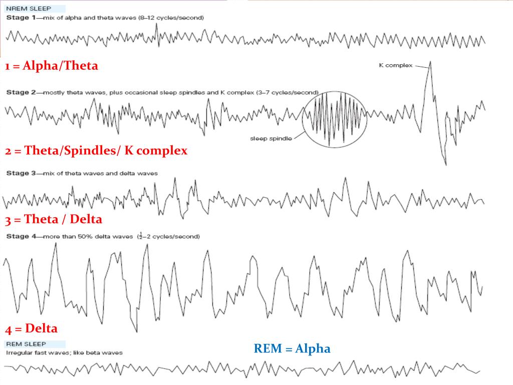 PPT Sleep the most common ASC PowerPoint Presentation, free download ID2495427