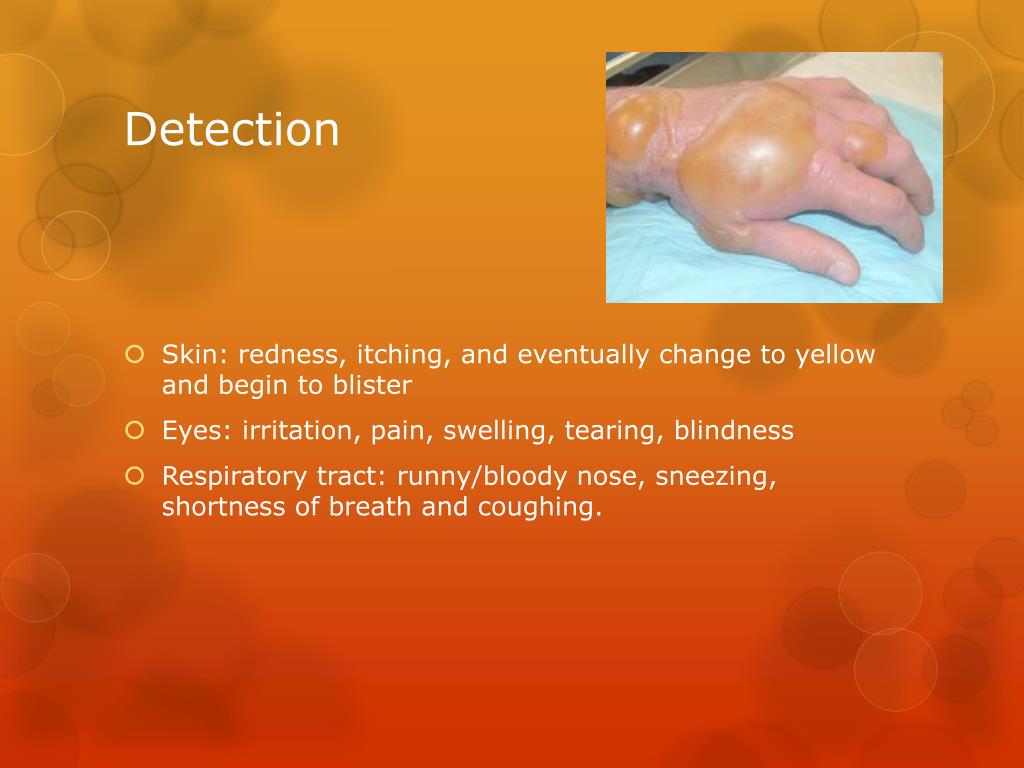 PPT Sulfur Mustard (Mustard Gas) PowerPoint Presentation, free