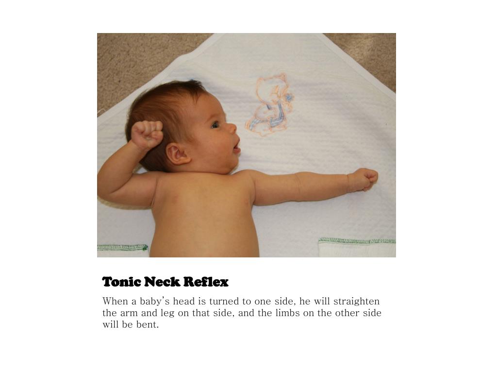 PPT Newborn Reflexes PowerPoint Presentation, free download ID2513715