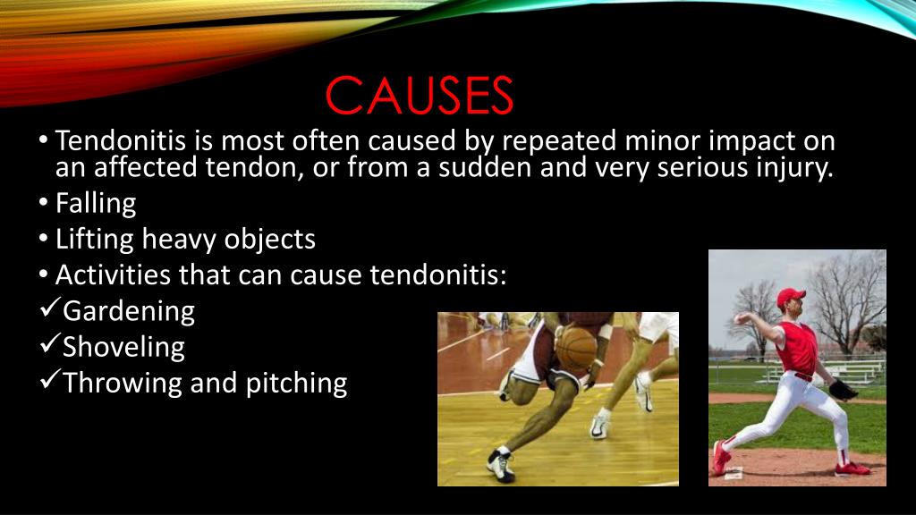 PPT Tendonitis PowerPoint Presentation, free download ID2523395