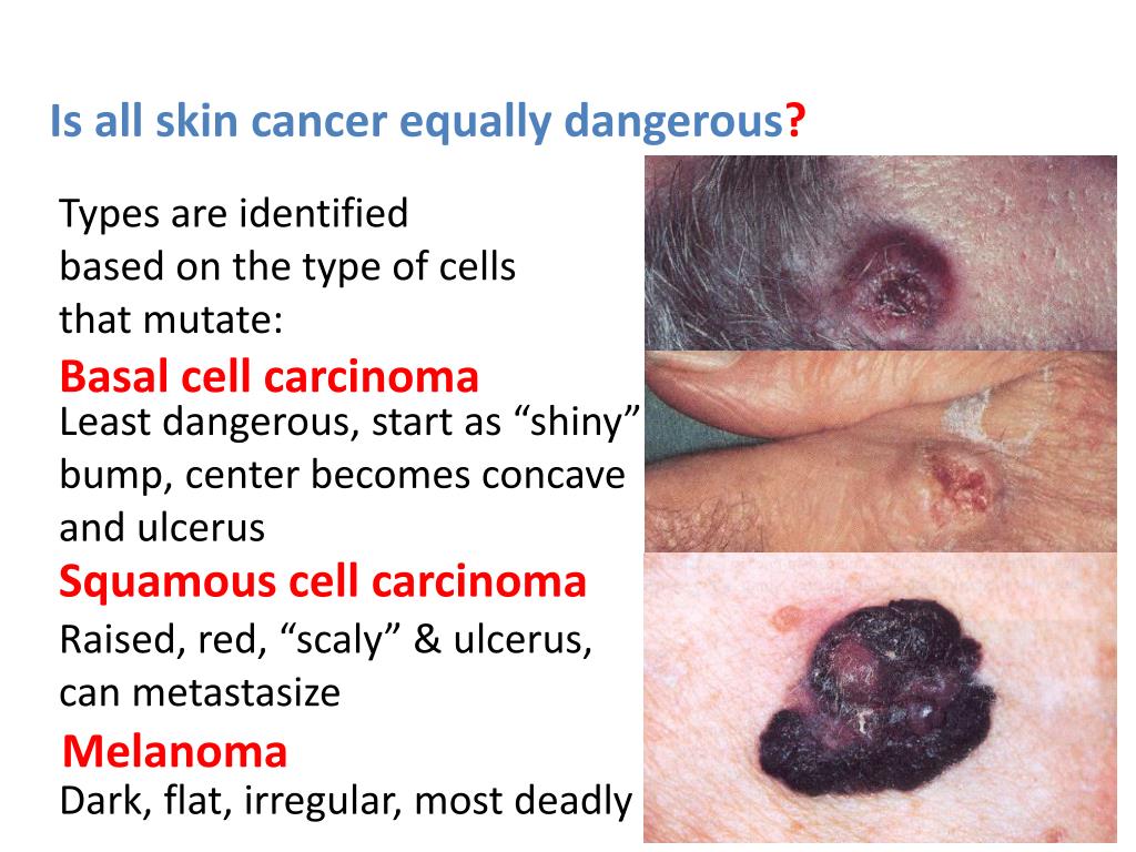 PPT Abnormal skin colorations Cyanosis Pallor Jaundice Albinism