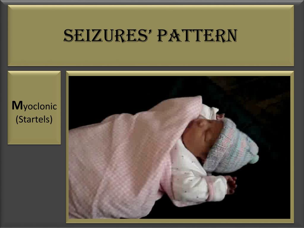 PPT Seizures E PILEPTIC / N on Epileptic What is that ??? PowerPoint