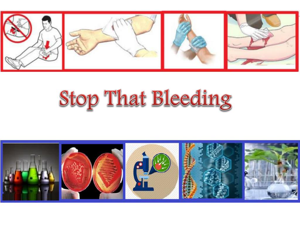 PPT Stop That Bleeding PowerPoint Presentation, free download ID