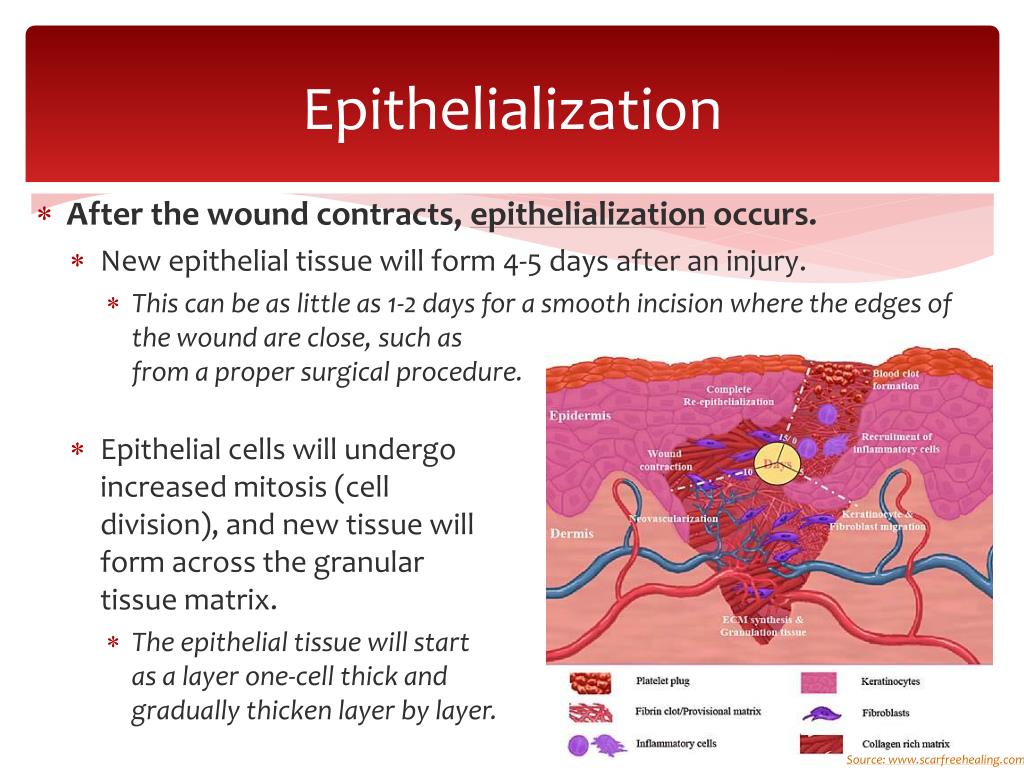 PPT Wound Repair PowerPoint Presentation, free download ID2621289