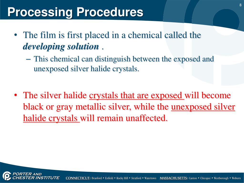 PPT Dental Xray Film Processing PowerPoint Presentation, free