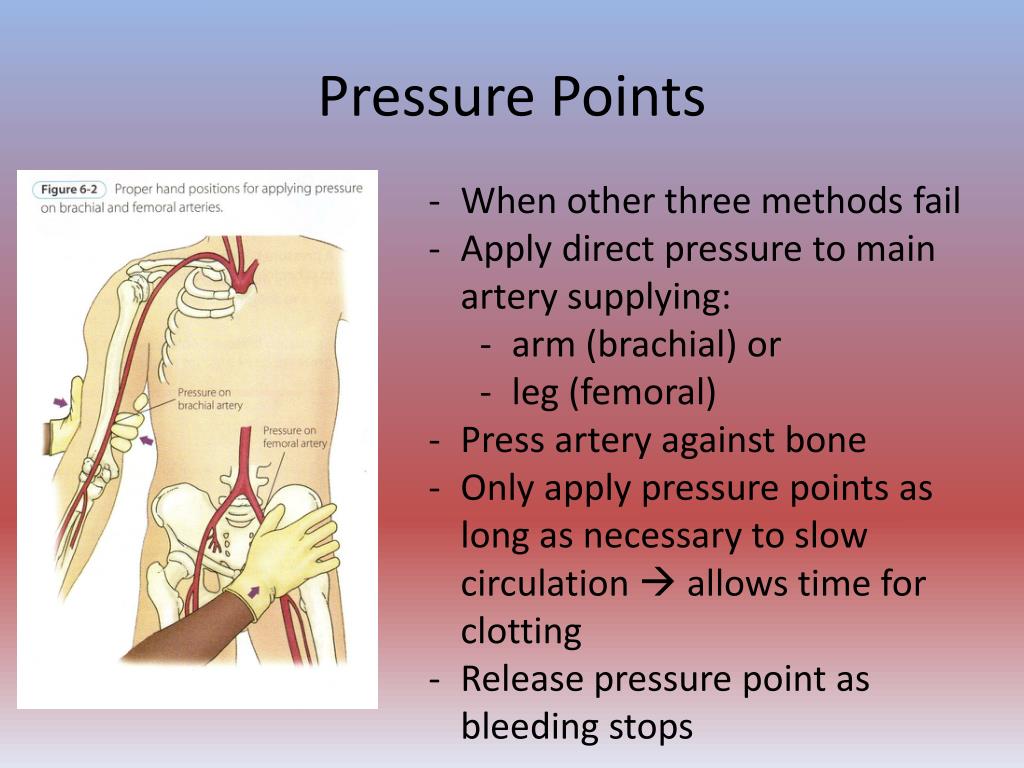 PPT First Aid Lecture Bleeding and Shock PowerPoint Presentation