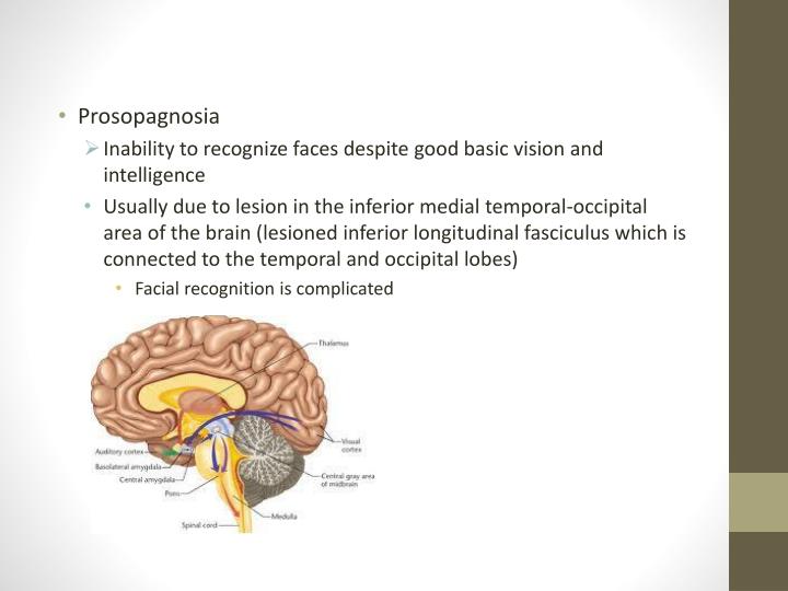 PPT Agnosia PowerPoint Presentation ID2678587