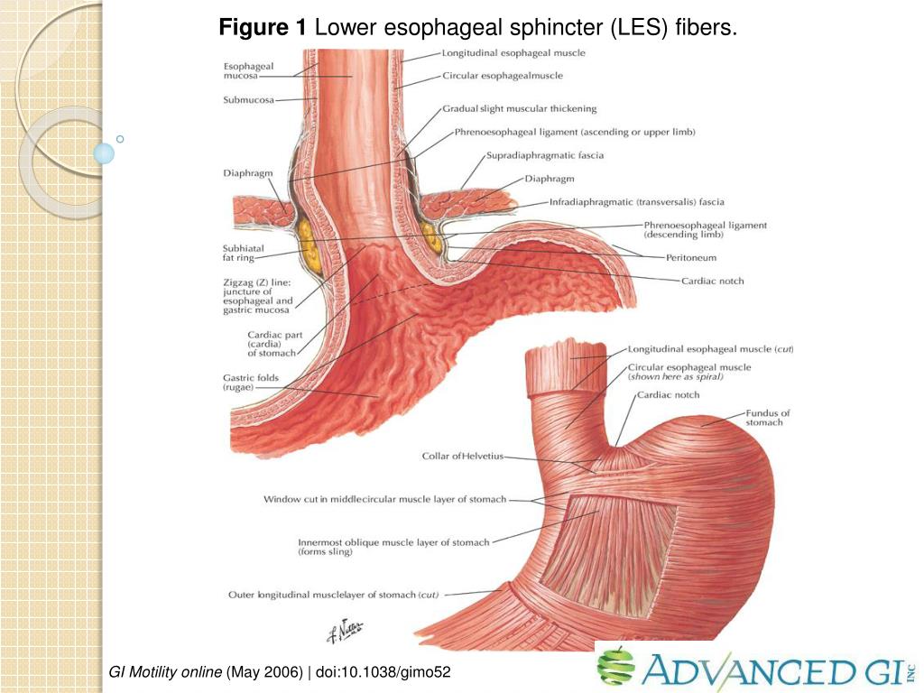 PPT Endoscopic Diagnosis of Hiatal Hernia PowerPoint Presentation
