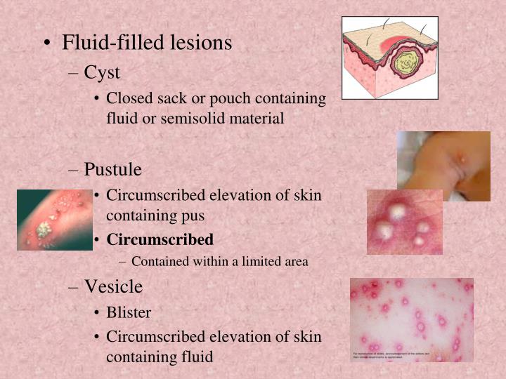 PPT The Integumentary System PowerPoint Presentation ID2739673