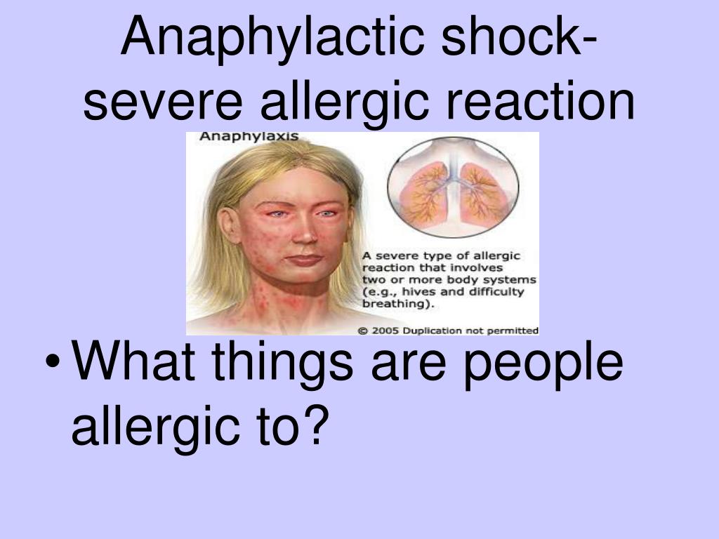 PPT Choking Emergencies PowerPoint Presentation, free download ID