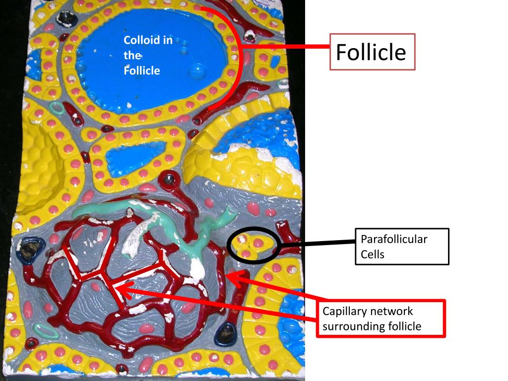 PPT Follicle with epithelium removed (showing colloid) PowerPoint