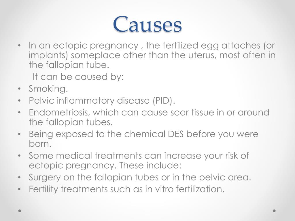 PPT Ectopic Pregnancy PowerPoint Presentation, free download ID2811168