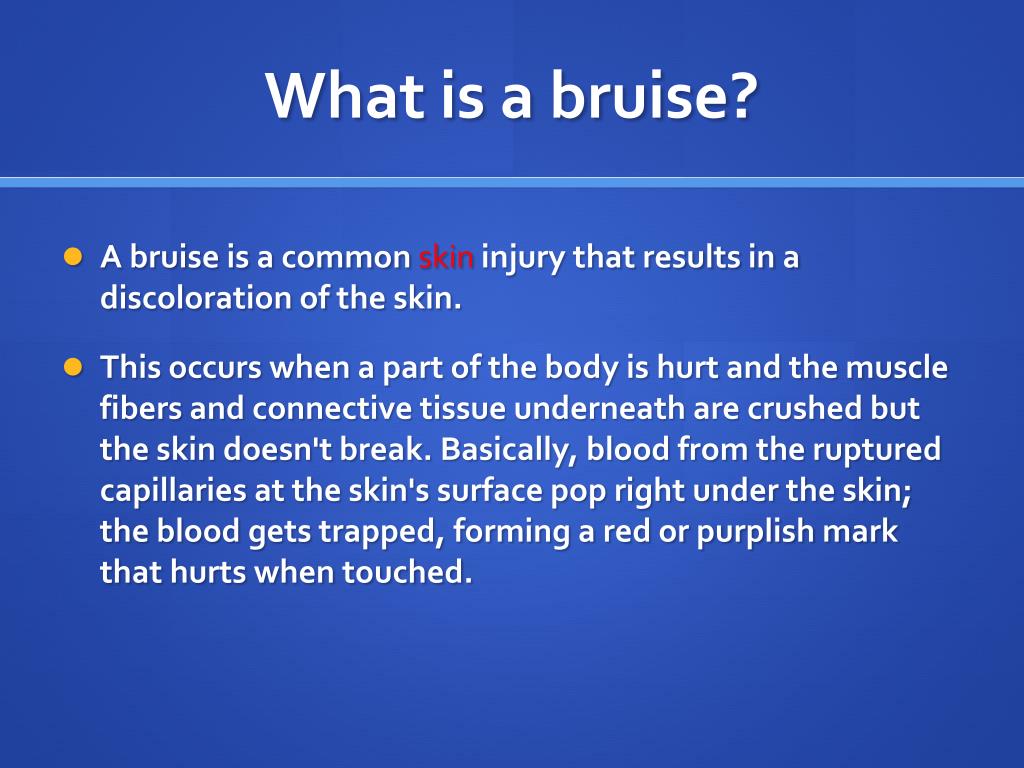 PPT Bruises PowerPoint Presentation, free download ID2813481