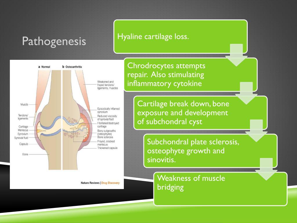 PPT osteoarthritis PowerPoint Presentation, free download ID2860262