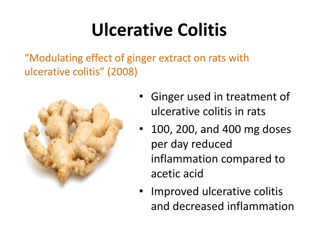 PPT Alternative Nutrition Therapy Ginger PowerPoint Presentation, free download ID2879464