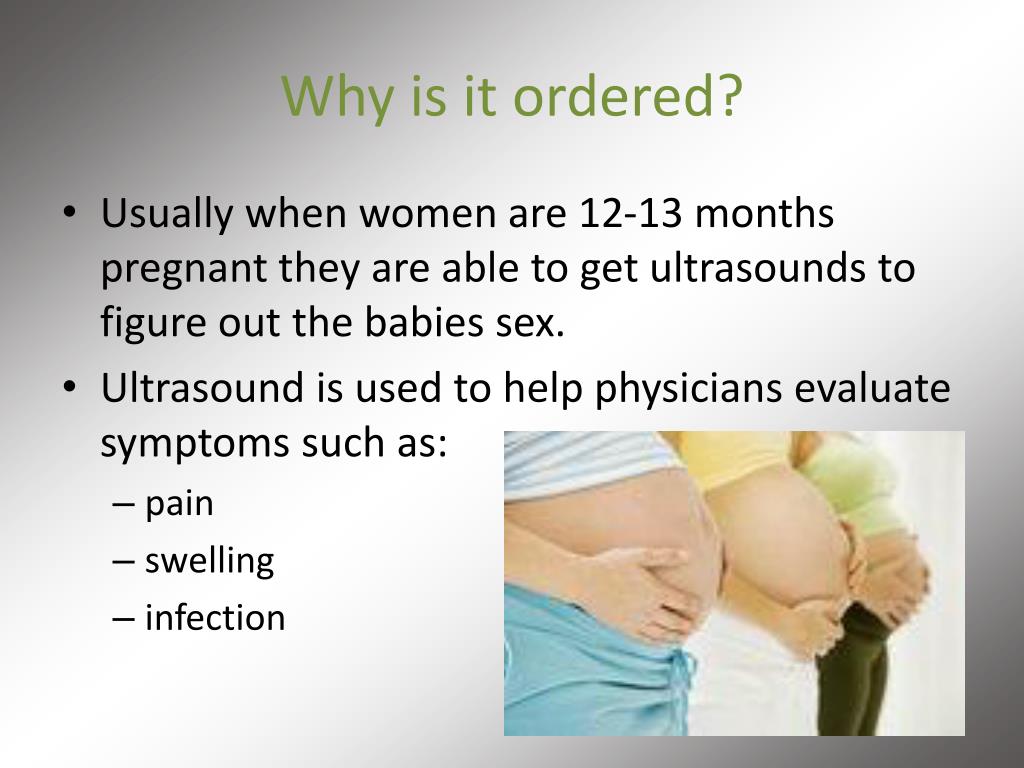 PPT ULTRASOUND PowerPoint Presentation, free download ID2915495