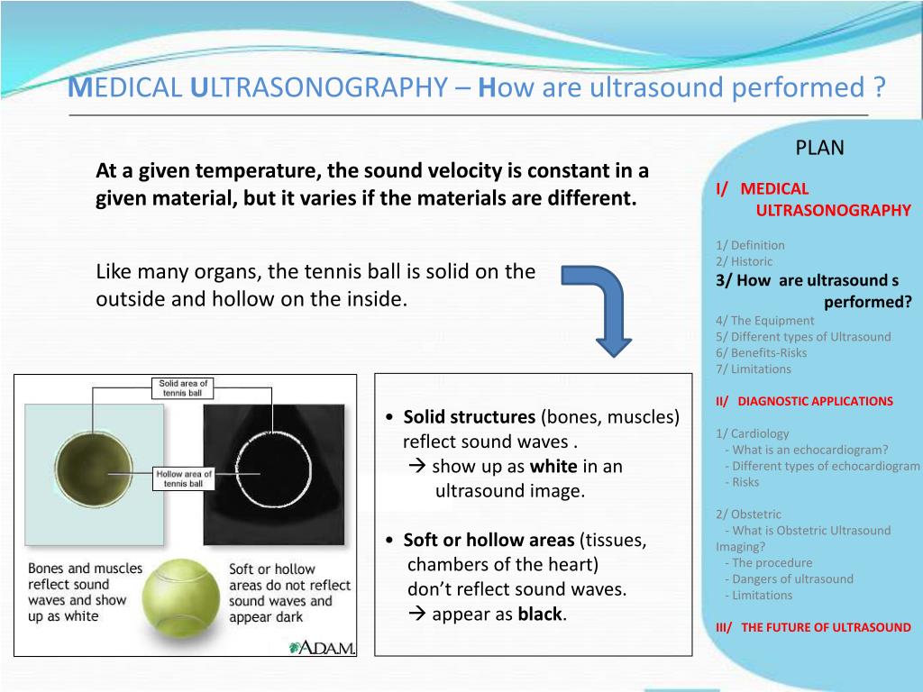 PPT Medical Ultrasonography PowerPoint Presentation, free download