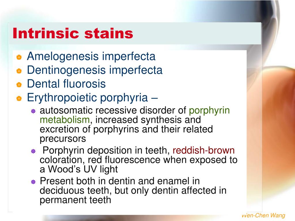 PPT ABNORMALITIES OF TEETH PowerPoint Presentation, free download