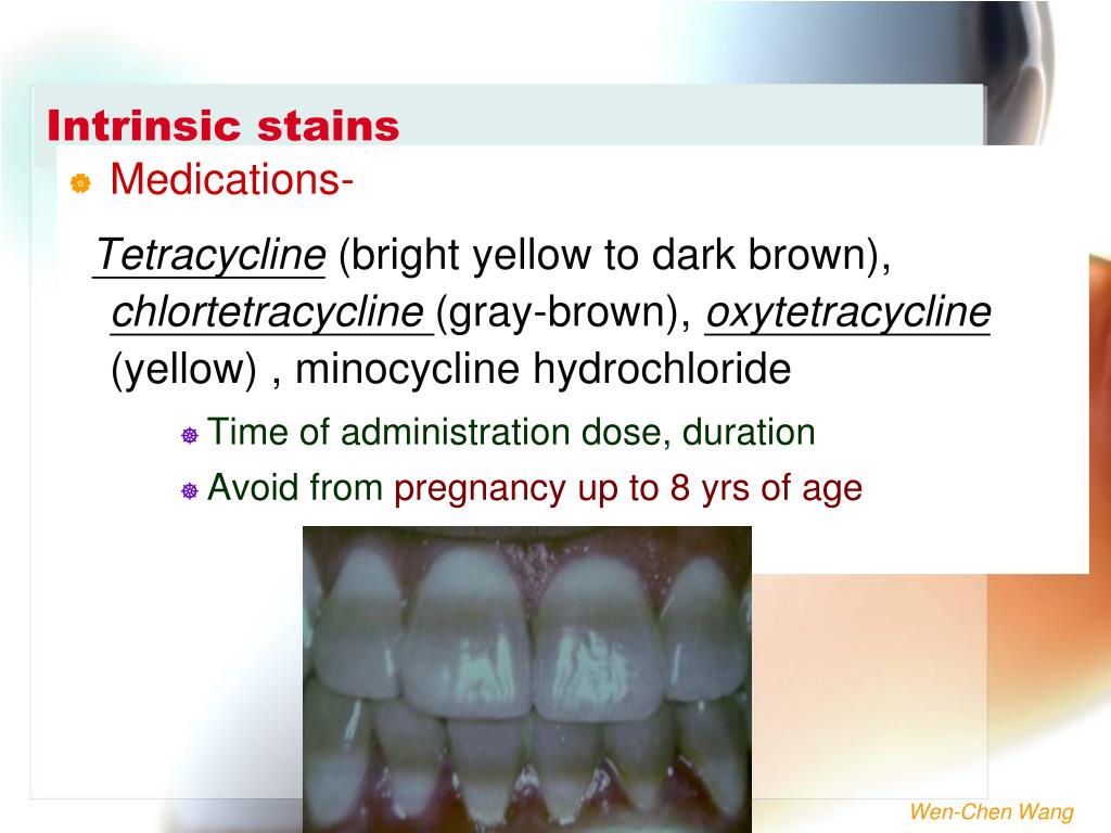PPT ABNORMALITIES OF TEETH PowerPoint Presentation, free download