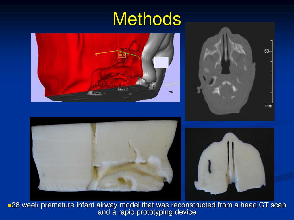 PPT - Nasal Cannula Intermittent Mandatory Ventilation (NC-IMV