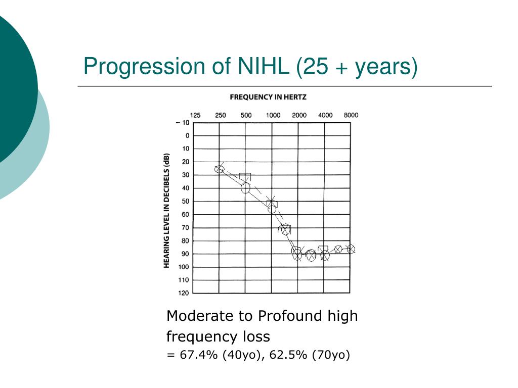 PPT NOISE INDUCED HEARING LOSS (NIHL) PowerPoint Presentation, free