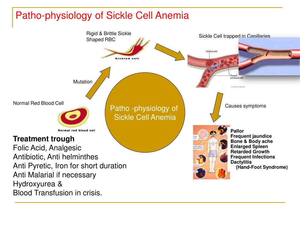 PPT Sickle Cell Anemia Control Program (A Major Tribal Health Program