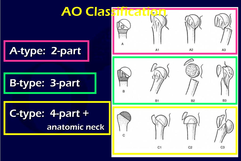 PPT Proximal Humerus PowerPoint Presentation, free download ID2939338