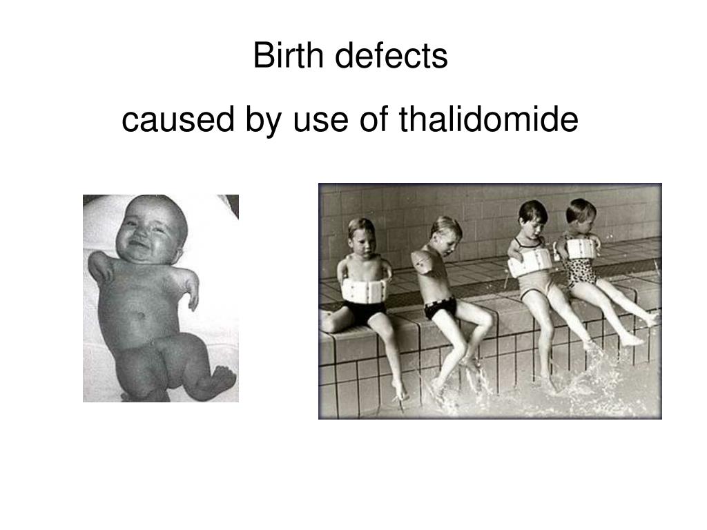 PPT Birth defects caused by use of thalidomide PowerPoint