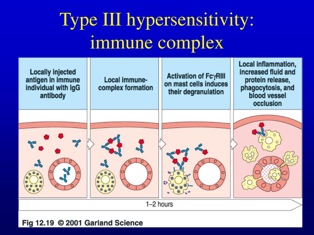 PPT Allergy and Hypersensitivity PowerPoint Presentation, free