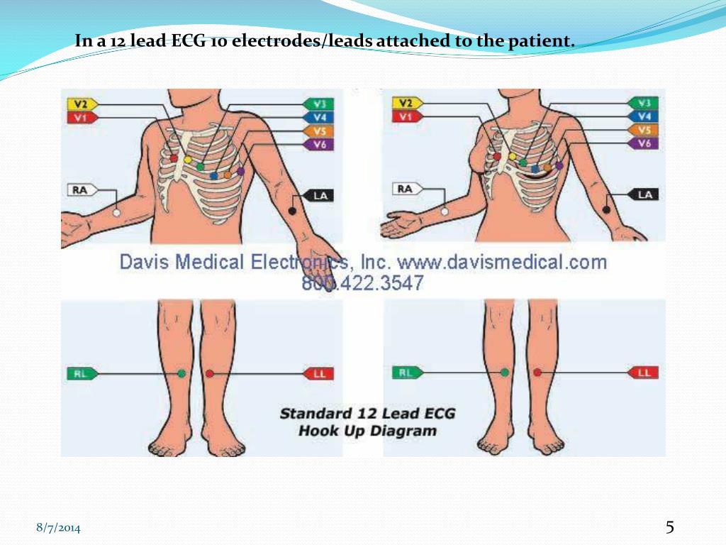 PPT BASIC 12 LEAD ECG INTERPRETATION PowerPoint Presentation, free