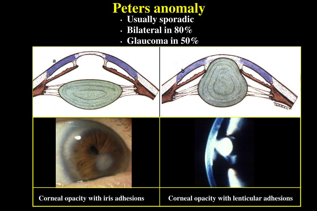 PPT CONGENITAL PowerPoint Presentation, free download ID