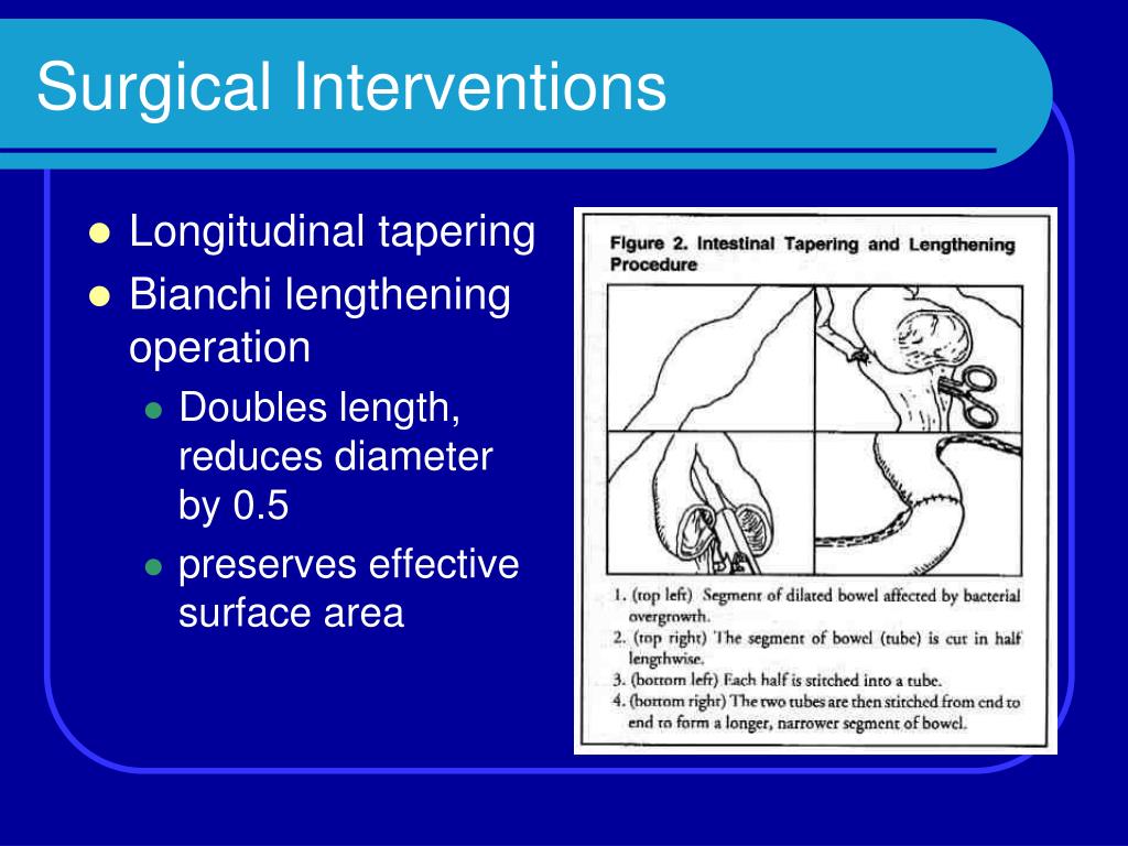 Step Procedure For Short Bowel Syndrome