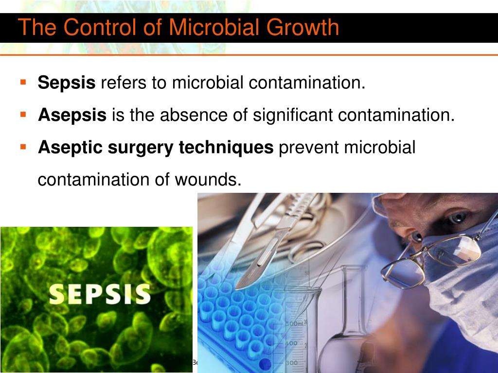 PPT The Control of Microbial Growth PowerPoint Presentation, free