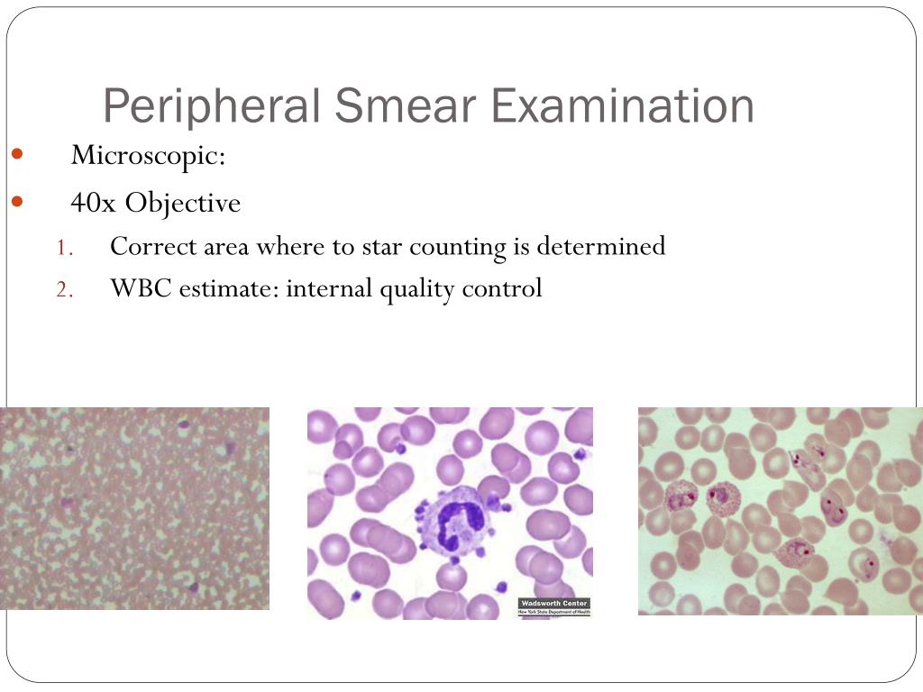 PPT Examination of Peripheral Blood Smear PowerPoint Presentation