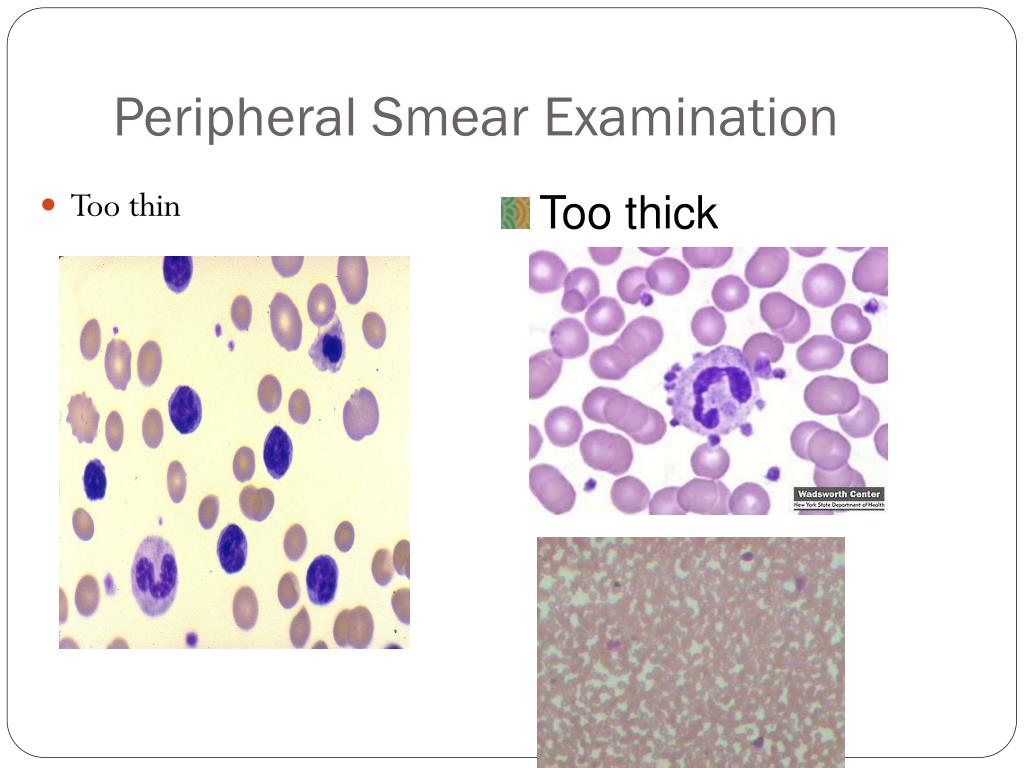 PPT Examination of Peripheral Blood Smear PowerPoint Presentation