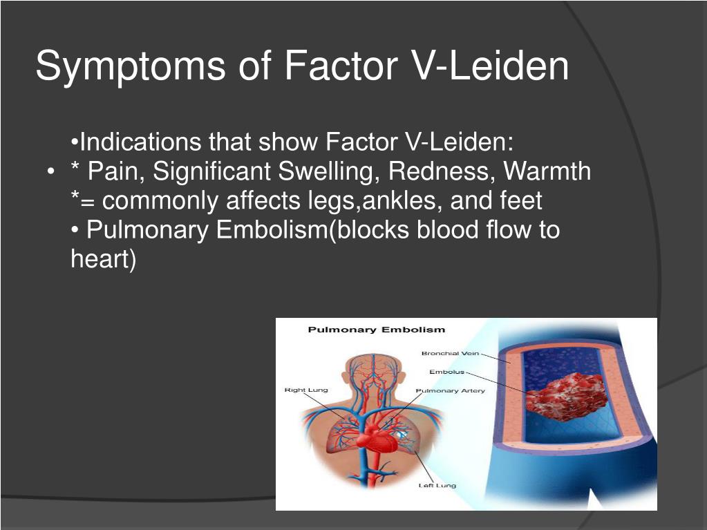 What Is Factor V Leiden
