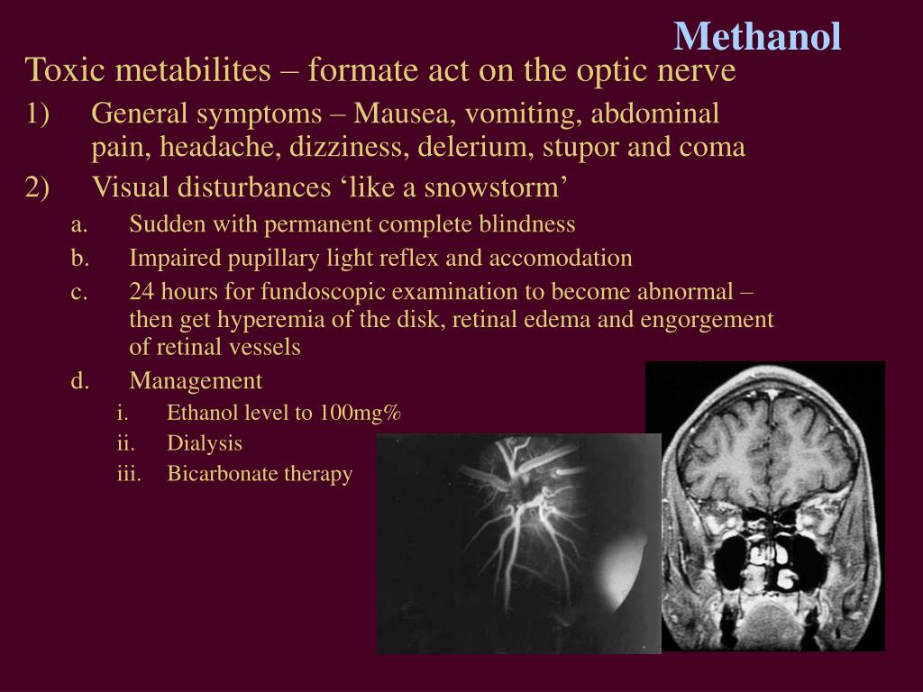 PPT Acute Vision Loss PowerPoint Presentation, free download ID3000924