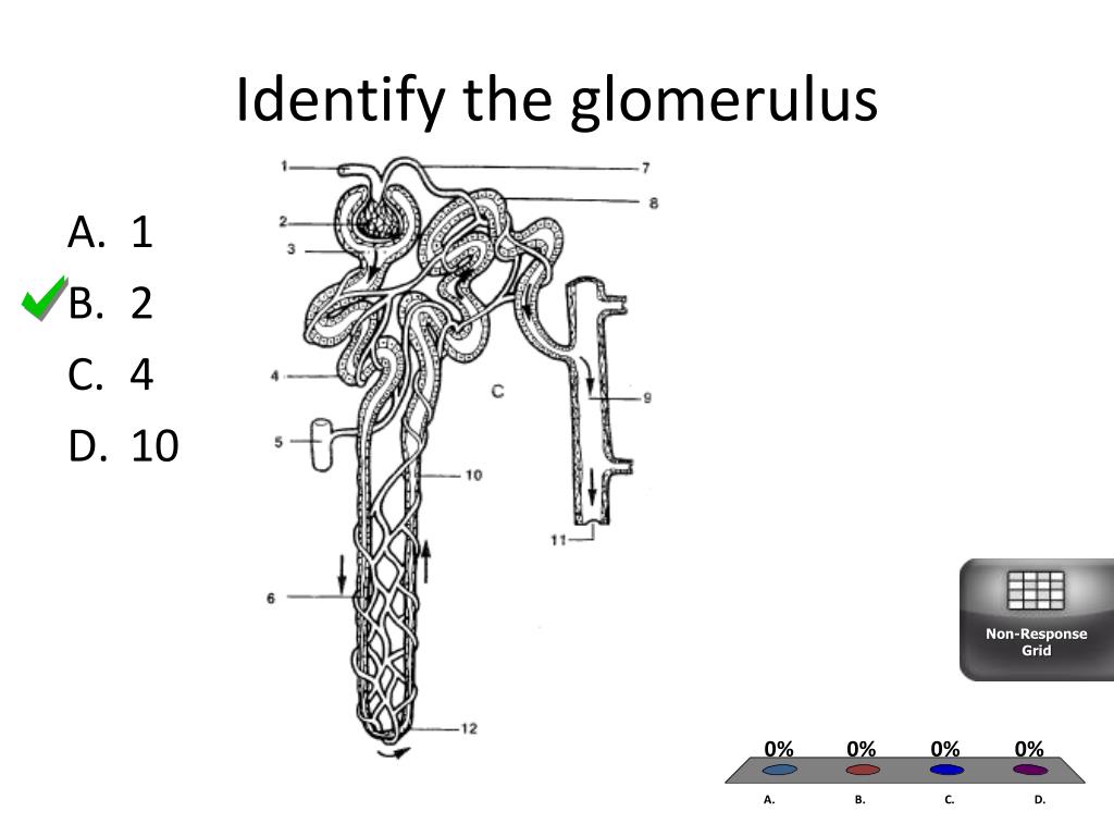 PPT Urinary System Review PowerPoint Presentation, free download ID