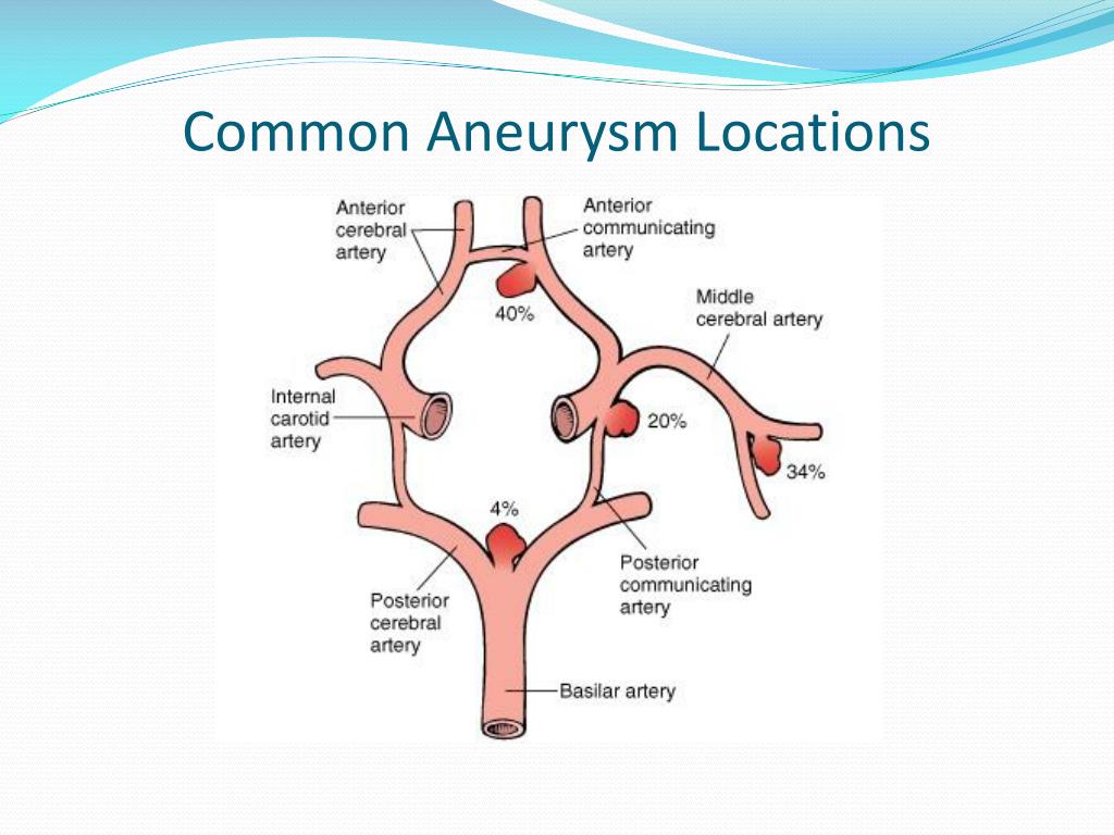 PPT Neuro Protective Anesthesia During Cerebral Aneurysm
