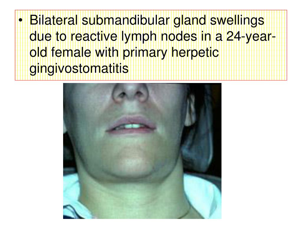 PPT Oral cavity & Pharynx Trachea PowerPoint
